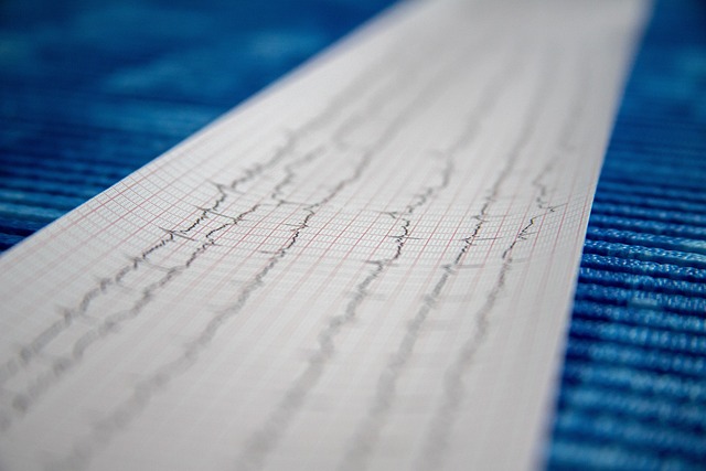 HDACs and Cardiac Hypertrophy: Decoding the Epigenetic Switches of Heart Growth